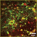 Мультиэлектродные матрицы — новые возможности  в исследовании пластичности нейрональной сети
