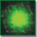 Метод ДНК-комет в оценке уровня повреждения ДНК лейкоцитов крови после фотодинамической терапии