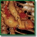 Новый взгляд на структурные изменения корня аорты при стенозе аортального клапана