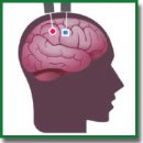 Brain–Computer Interfaces with Intracortical Implants for Motor and Communication Functions Compensation: Review of Recent Developments