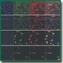 Новый тканеинженерный сосудистый матрикс на основе регенерированного фиброина шелка: исследование <i>in vitro</i>