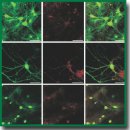 Сравнительный анализ действия фотосенсибилизаторов фотосенс, фотодитазин и гиперицин на клетки глиомы и первичные нейрональные культуры <i>in vitro</i>