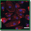 Эффективность использования эндотелиальных колониеформирующих клеток для создания тканеинженерного сосудистого протеза в условиях <i>in vitro</i> 
