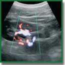 Modern Possibilities of Kidney Ultrasound Diagnosis in Children
