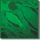 Novel Fluorescent Probes for Amyloid Detection