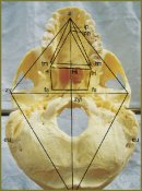 Антропометрическое изучение морфологии HIP-плоскости  и корреляционных связей ее параметров с размерами мозговой  и лицевой частей черепа