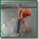 Гистологическое обоснование необходимости проведения радиочастотной абляции легочных артерий у пациентов с вторичной легочной гипертензией высокой степени