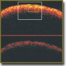 Мультифотонная томография и кросс-поляризационная оптическая когерентная томография в диагностике глиальных опухолей головного мозга: пилотное исследование