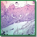 Биосовместимость и костная интеграция титановых имплантатов различной пористости с кальций-фосфатным покрытием и без покрытия
