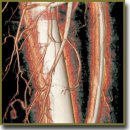 Применение ротационной компьютерной томографической ангиографии и 3D-моделирования при планировании одномоментной реконструкции тазового дна после эвисцерации органов малого таза