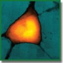 Study of Brain Cells in Neurodegenerative Diseases: Raman Microspectroscopy and Scanning Ion-Conductance Microscopy