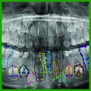 Neural Network Technologies for Age Estimation in Children from Orthopantomograms (a Pilot Study)
