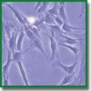 The Use of High-Concentration Collagen-Based Composition and Gelatin Granules as Bioinks for Extrusion 3D Bioprinting of Porous-Structured Hydrogel Constructs