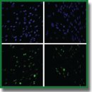 Measurable Metrics of Mesenchymal Stem Cell Aging