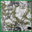 A New Quantitative Method for Assessing the Ultrastructure of Cardiomyocyte Mitochondria of the Right Atrial Appendage