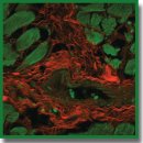 Three-Dimensional Imaging of Human Myocardial Collagen Fibers Using Trypan Blue Staining