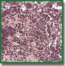 The Original Mouse Models of Glioblastoma: Analysis of Pathophysiological Characteristics of Transplanted Tumor Tissue